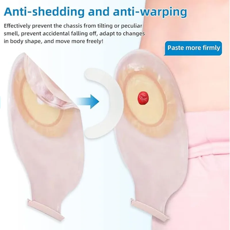 Tıbbi Ostomi Torbası Güçlendir - Medical Tape incelemesi ve fiyatı